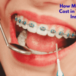 Braces Cost in Texas Without Insurance